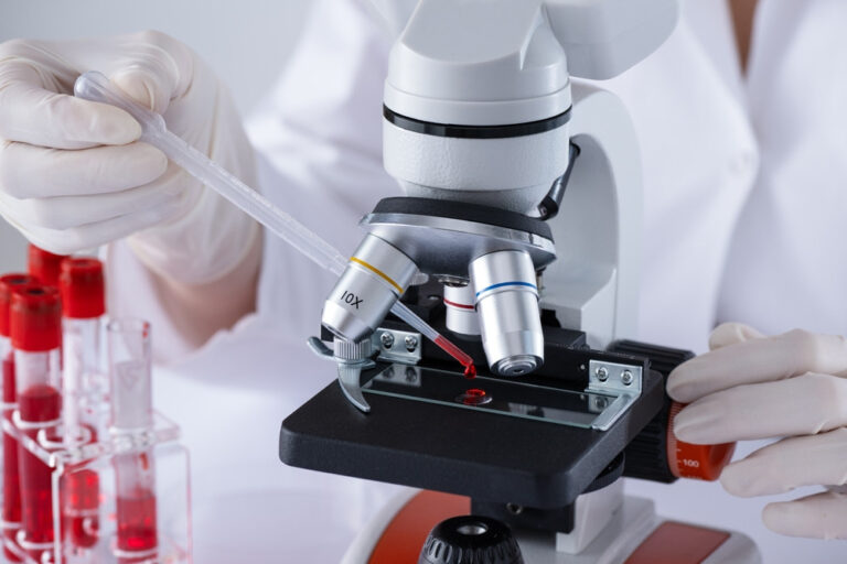 Scientist examining a blood sample under a microscope in a laboratory