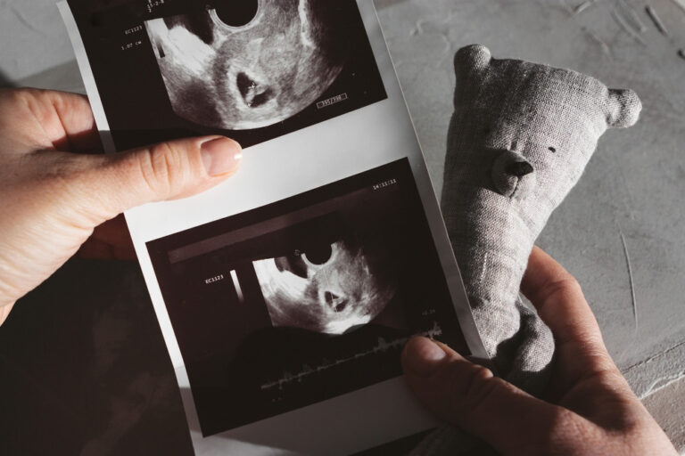 Early pregnancy ultrasound results held in a patient's hands