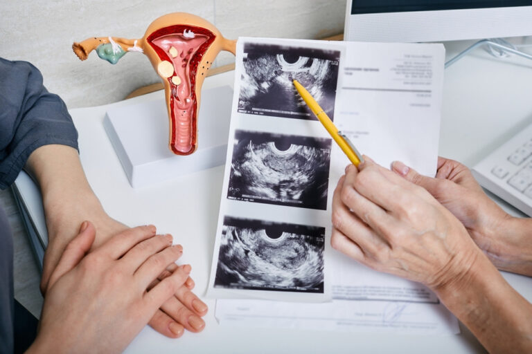 Gynaecologist showing a woman the ultrasound of her ovaries during a consultation