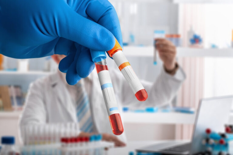 Medical blood sample in a laboratory