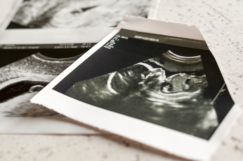 Ultrasound photographs of a pregnancy at 4 weeks and 20 weeks, selective focus